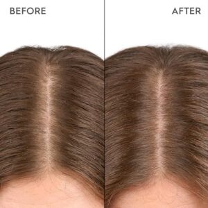 Dry and Sensitive Scalp